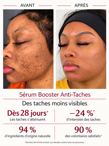 Sérum Booster Anti-Taches