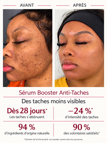 Sérum Booster Anti-Taches
