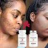 Précommande Pack Transformation SKYNOXY DUO – 3 Mois