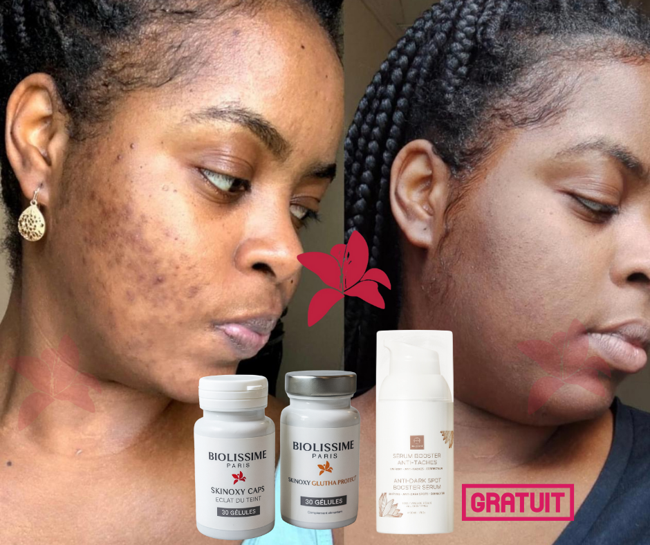 Précommande Pack Découverte Skinoxy Duo – 1 Mois de Beauté Intérieure