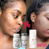 Précommande Pack Découverte Skinoxy Duo – 1 Mois de Beauté Intérieure
