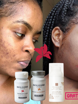 Précommande Pack Découverte Skinoxy Duo – 1 Mois de Beauté Intérieure