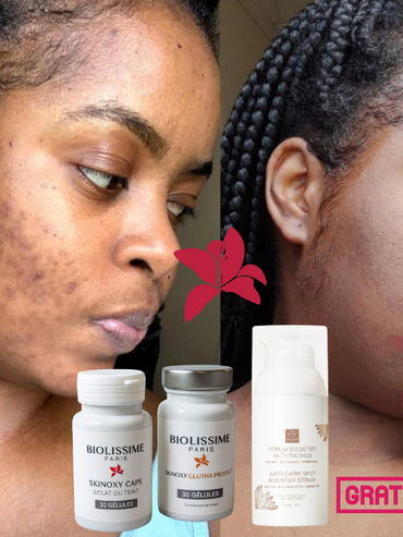 Précommande Pack Découverte Skinoxy Duo – 1 Mois de Beauté Intérieure