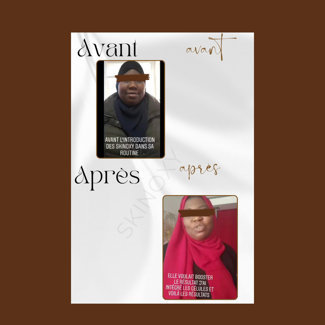 Précommande SKINOXY Pack Renaissance – 6 Mois