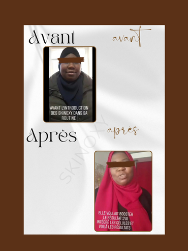 Pack Transformation  Anti-Taches, Mélasma & Anti-Âge Skinoxy – 3 Mois