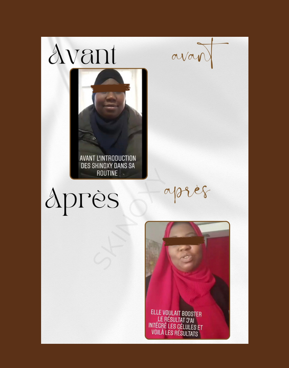 Pack Transformation  Anti-Taches, Mélasma & Anti-Âge Skinoxy – 3 Mois